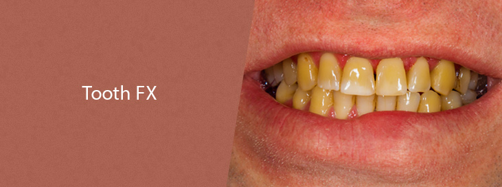 Tooth FX