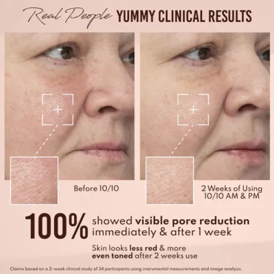 Danessa Myricks Beauty Yummy Skin 10/10 Barrier Boost Hyaluronic Acid + Ectoin Plumping Serum
